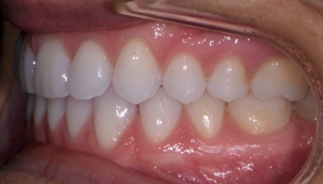 Panama City FL Orthodontics